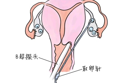 http://shanghai.vdtfzz.com/post/205.html|上海供卵助孕